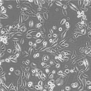 HCT-116 Cells#人結(jié)腸癌細(xì)胞系低代次|培養(yǎng)基|贈STR圖譜