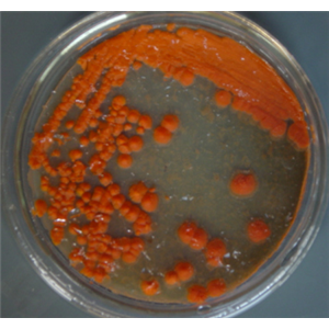 Mortierella Ramanniana Var. Angulispora