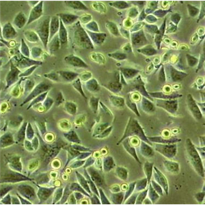 Mortierella Rostafinskii